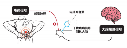 【ZE科普】一樣是電，為什么名字如此花哨