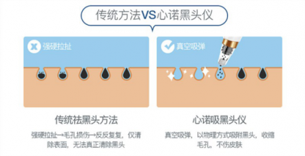 雙11最值得入手的面部清潔電器！美國心諾黑頭儀價格直降一半！