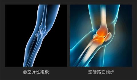 小米眾籌首款智能折疊跑步機(jī)來襲，讓愛跑步的人有“地”放矢
