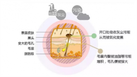 讓你的黑頭全退散！黑頭儀有用嗎？