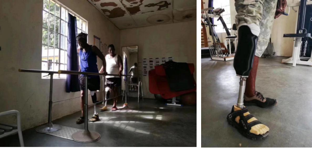 先臨三維3D數(shù)字化解決方案，援助塞拉利昂 3D Sierra Leone 醫(yī)療輔具定制項(xiàng)目