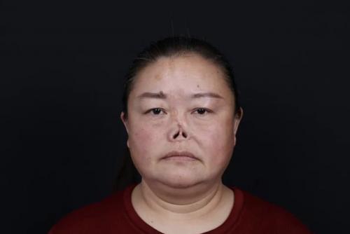 她，被羞辱欺凌40年，2020年成為新氧公益救助第一人
