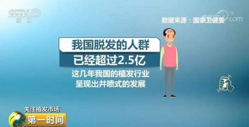 武漢新生植發(fā)：90后加入脫發(fā)大軍，3D植發(fā)技術幫助有效拯救顏值