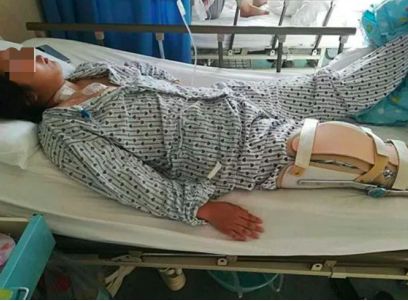 水滴籌·水滴公益助單親爸爸救骨癌女兒：我與女兒相依為命，不能沒有她