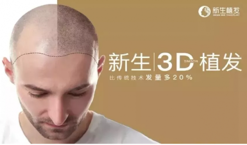 上海新生成頭部植發(fā)機(jī)構(gòu)，3D植發(fā)技術(shù)全球推廣推動(dòng)行業(yè)發(fā)展