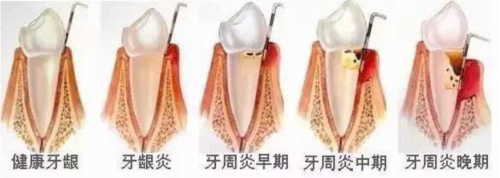 小米有品眾籌超10000000！素諾智能可視潔牙儀T11Pro為何一炮而紅？