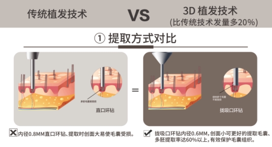 以技立信·植發(fā)無(wú)憂，成都新生植發(fā)3D植發(fā)讓消費(fèi)者更加安全放心