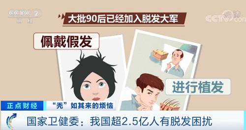 杭州新生植發(fā)：大批90后脫發(fā)，多數人進行3D植發(fā)