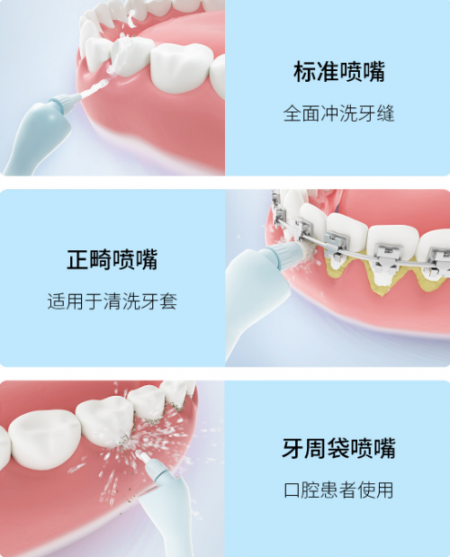 眾籌價僅269元！素諾智能可視沖牙器C3 pro小米有品眾籌開搶