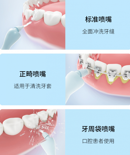 正畸人士福音！素諾智能可視沖牙器C3 pro看得清，沖得凈