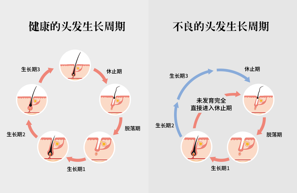 拯救頭頂大事，采用創(chuàng)新配方REDENICAL的DR ZERO來到中國