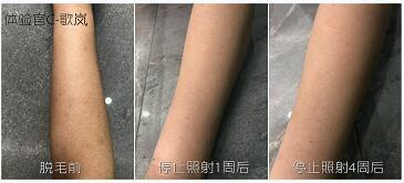 這3款網(wǎng)紅脫毛儀評(píng)測(cè)大集錦，你都了解過了嗎？