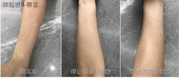 這3款網(wǎng)紅脫毛儀評(píng)測(cè)大集錦，你都了解過了嗎？