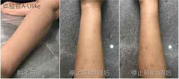 這3款網(wǎng)紅脫毛儀評(píng)測(cè)大集錦，你都了解過了嗎？