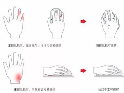 當(dāng)鼠標(biāo)“垂直”，會(huì)發(fā)生什么？多彩垂直鼠標(biāo)體驗(yàn)